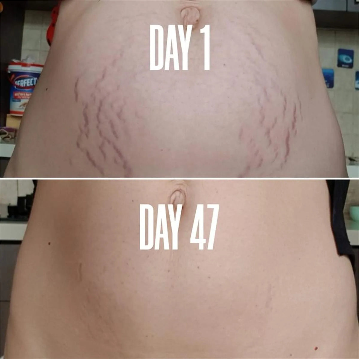 StretchMark Fade & Firm Cream™