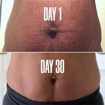 StretchMark Fade & Firm Cream™