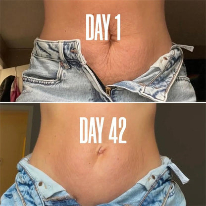 StretchMark Fade & Firm Cream™